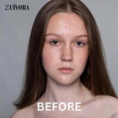 Zuivora™ GlowRestore Dagcrème